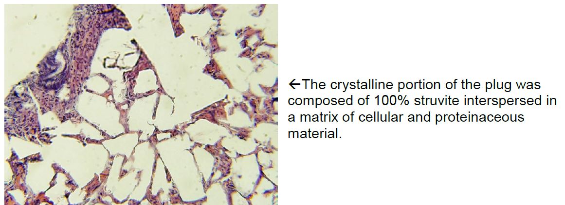 cystalline portion of the plug was composed of 100% struvite interspersed in a matrix of cellular and proteinaceous material