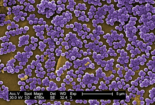 MRSA bacteria under magnification