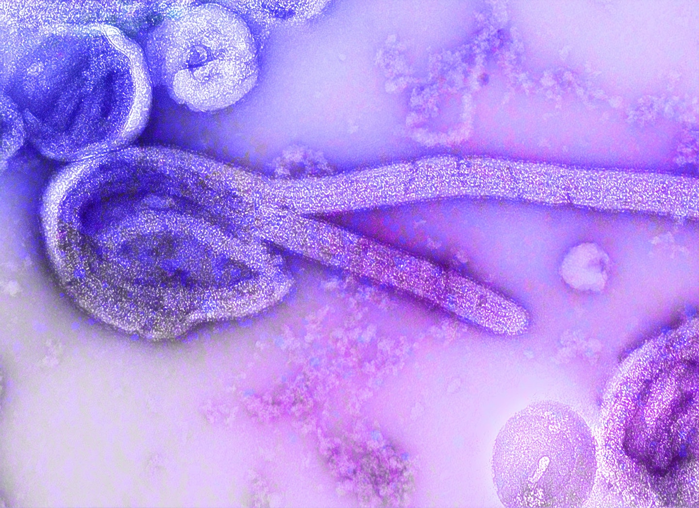A microscopic image, in purple and pink, of an ebola virus