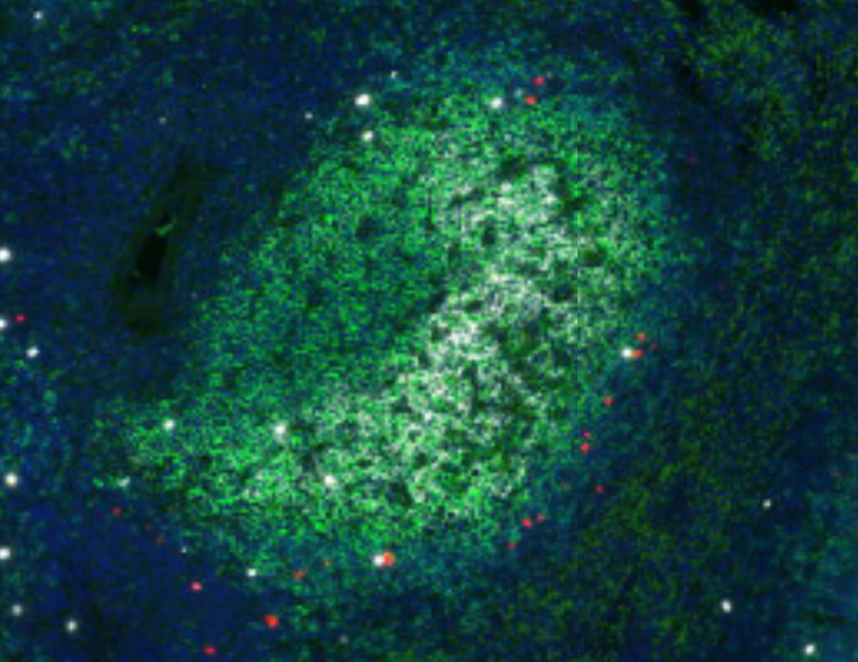 Virus-specific CAR T cells (red) in contact with virus-producing cells (white) in a B cell follicle (green). Image by Hadia Abdelaal, PhD, former postdoc in Skinner’s lab.