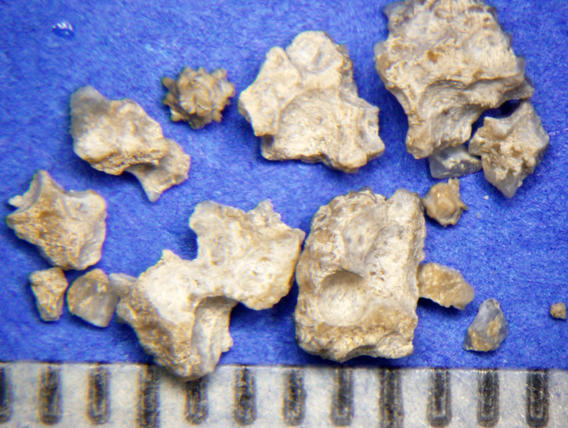 multiple canine struvite urate bladder stones