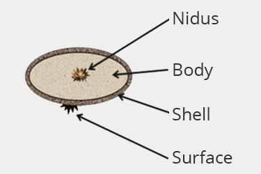 diagram of the structures within a urolith, nidus, body, shell, and surface
