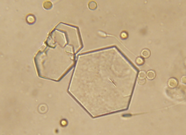 cystine urine crystals in a dog as seen from a microscope