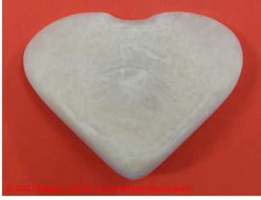 a canine struvite urolith that has a unique heart shape