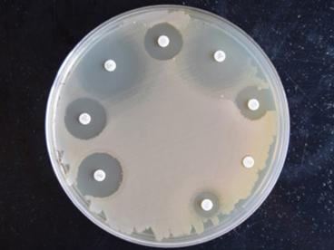 Petri dish displaying a microbiome assessment with eight white areas, seven of which are ringed by a darker area