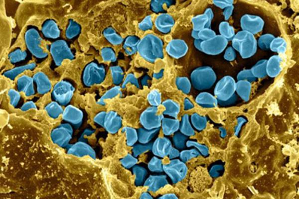 blue bacterials cells invading a yellow macrophage