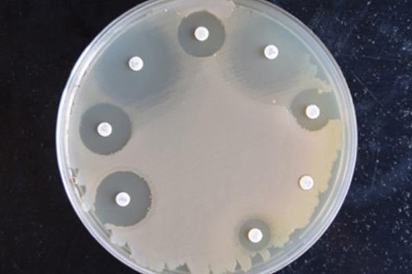 bacterial growth in a petri dish