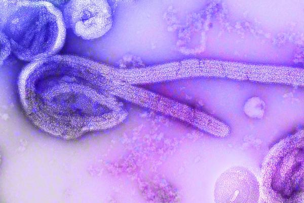 A microscopic image, in purple and pink, of an ebola virus