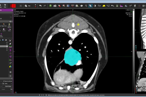 A single-slide CT image of a dog with a lung mass. The mass is highlighted in blue. The yellow highlight is muscle within the back that was used as the reference tissue for the texture analysis data for the case.