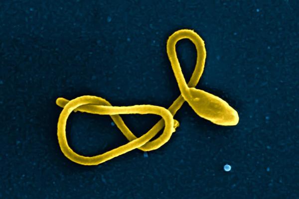 A yellow Ebola virus particle against a navy blue background