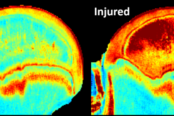 An MRI image of Legg-Calvé-Perthes disease in a piglet