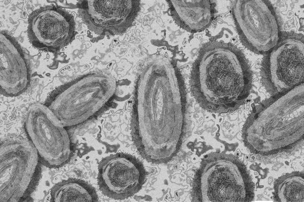 Microscope image of the monkey pox virus