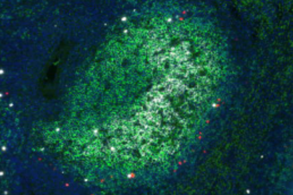 Virus-specific CAR T cells (red) in contact with virus-producing cells (white) in a B cell follicle (green). Image by Hadia Abdelaal, PhD, former postdoc in Skinner’s lab.